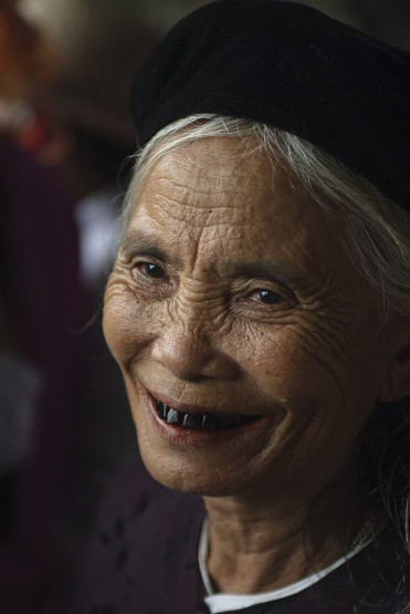 Tooth blackening ritual in Vietnam